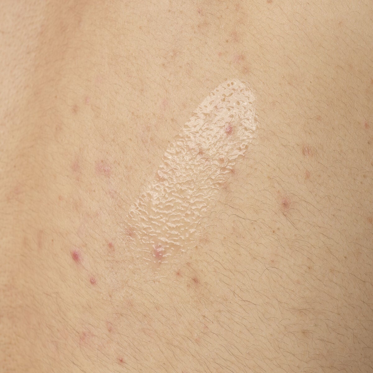 salicylic-acid-0-5-body-serum-j2 ORD-salicylic-acid-05-body-240ml-application.jpg
