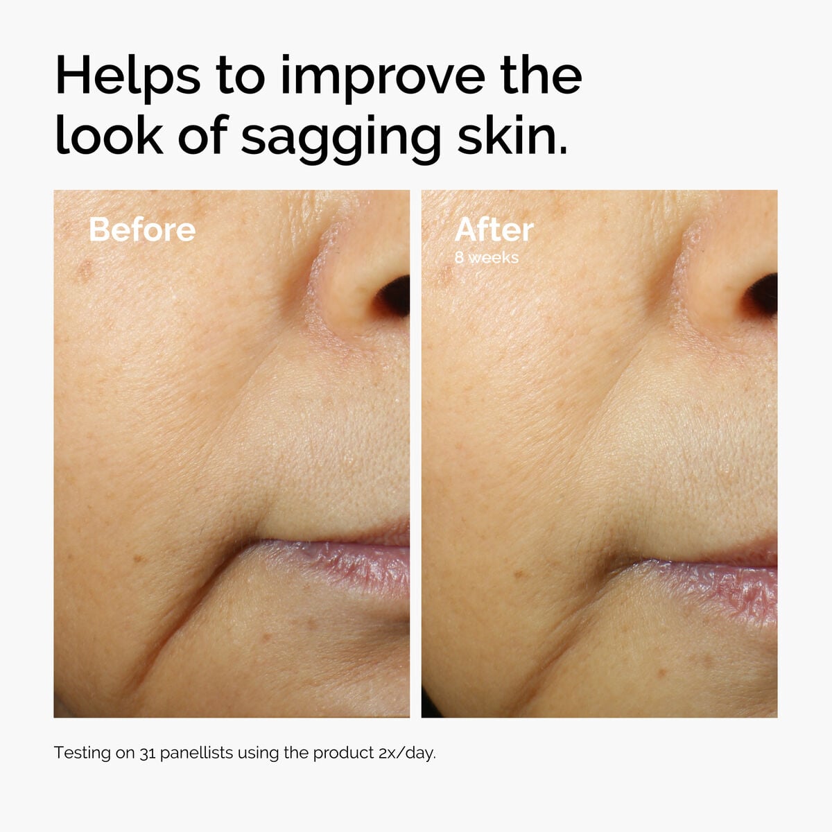 caffeine-3-escin-1-face-serum-t7 ord-caffeine-3pct-escin-1pct-face-serum-before-after-sagging.jpg