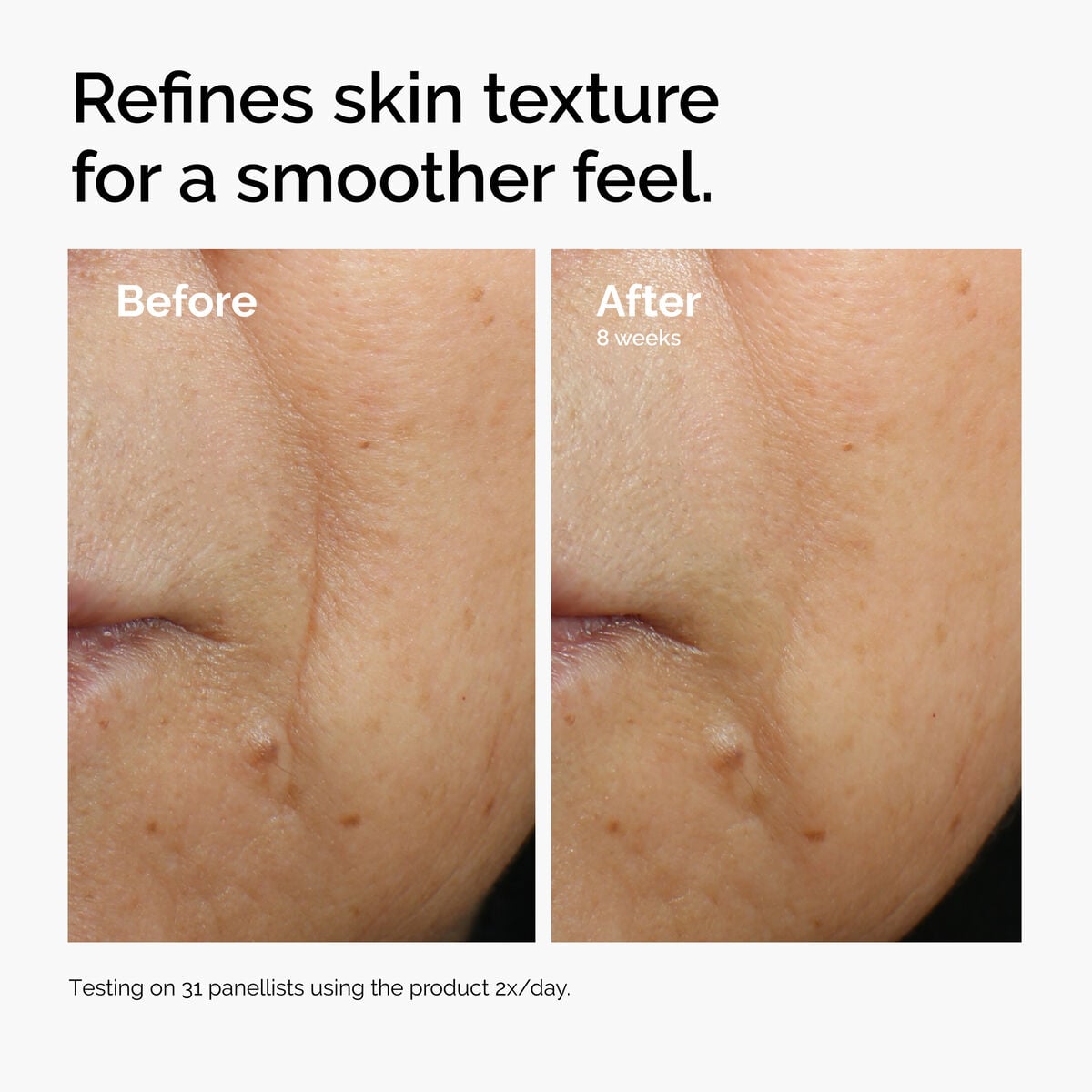 caffeine-3-escin-1-face-serum-t7 ord-caffeine-3pct-escin-1pct-face-serum-before-after-texture.jpg
