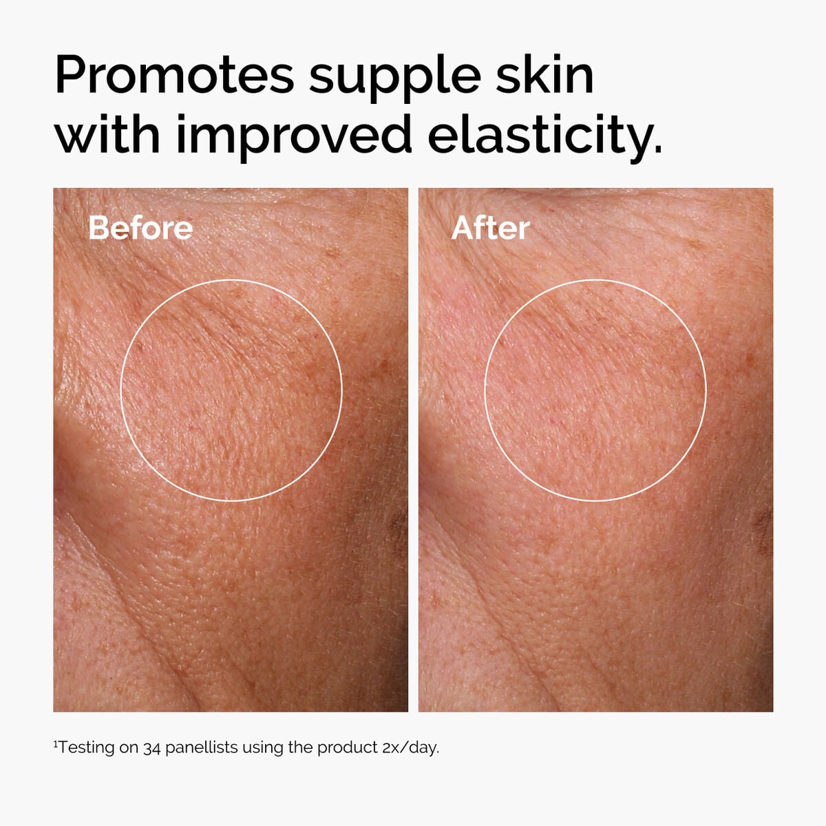 hyaluronic-acid-2-b5-with-ceramides-s1 ord-hyaluronic-acid-2pct-b5-hydrating-serum-before-after-elasticity.jpg