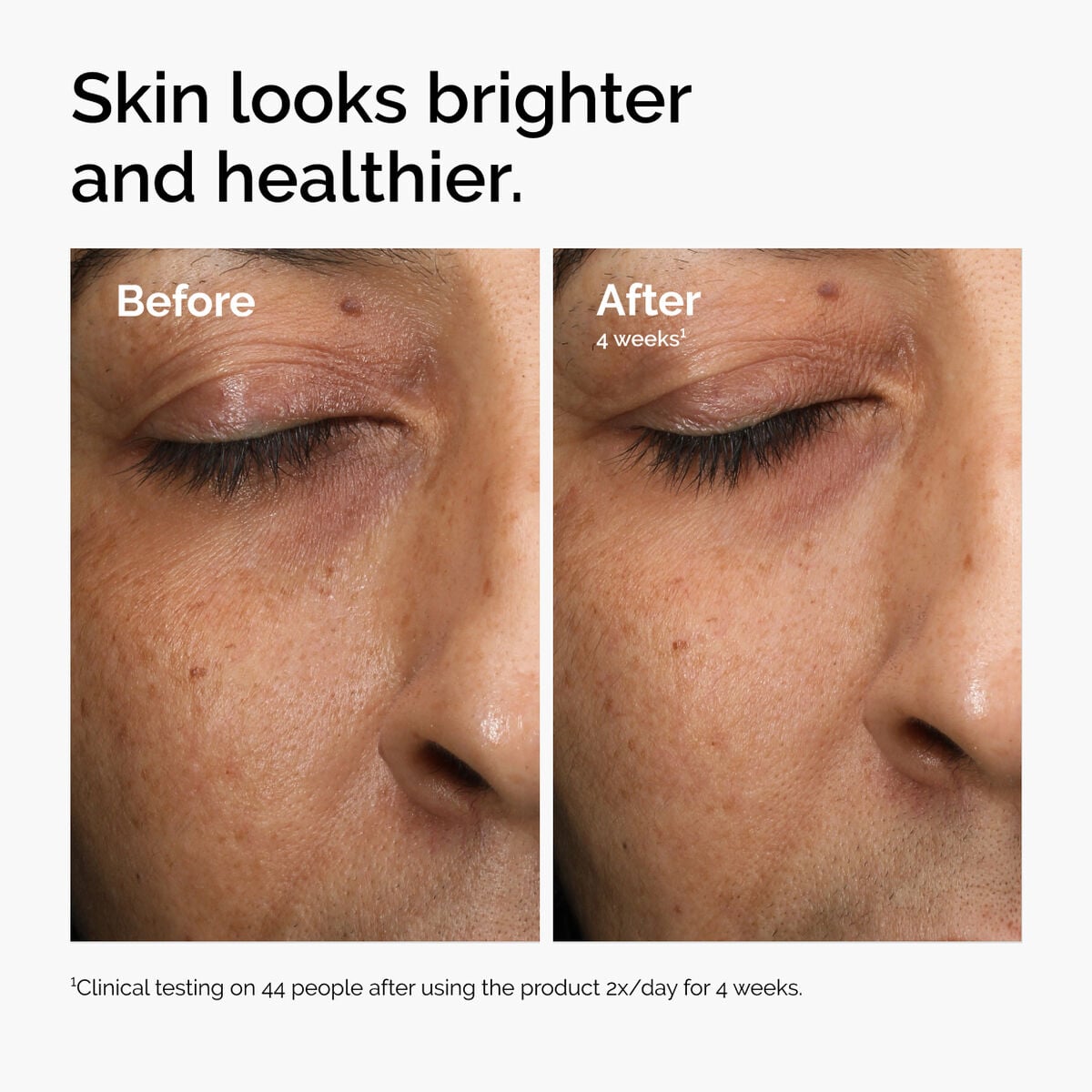 multi-antioxidant-radiance-serum-p8 ord-mars-before-after-healthy.jpg