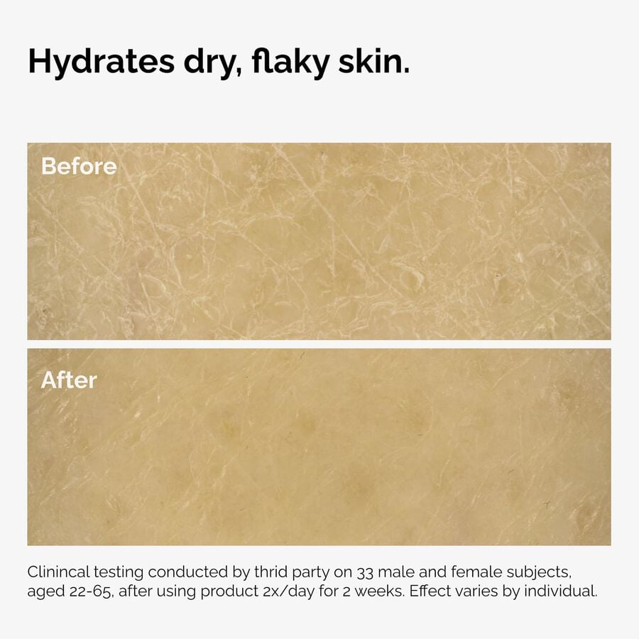the-body-care-collection-k4 ord-natural-moisturizing-factors-inulin-body-before-after-graphic-02.jpg