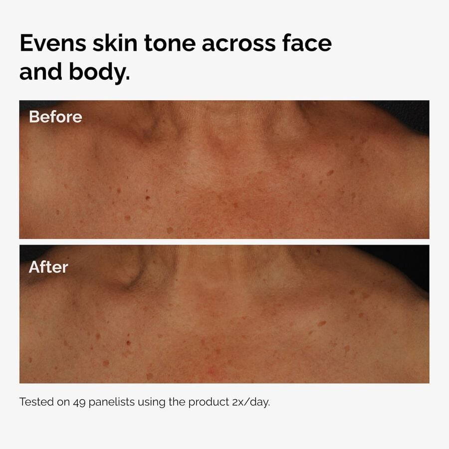 the-body-care-collection-k4 ord-niacinamide-face-body-serum-before-after-even-tone-graphic.jpg