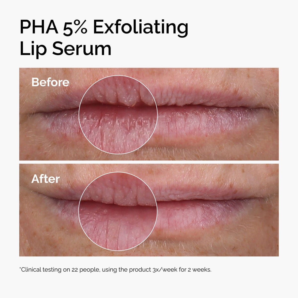 pha-5-exfoliating-lip-serum-b8 ord-pha-5pct-lip-exfoliating-serum-before-after.jpg